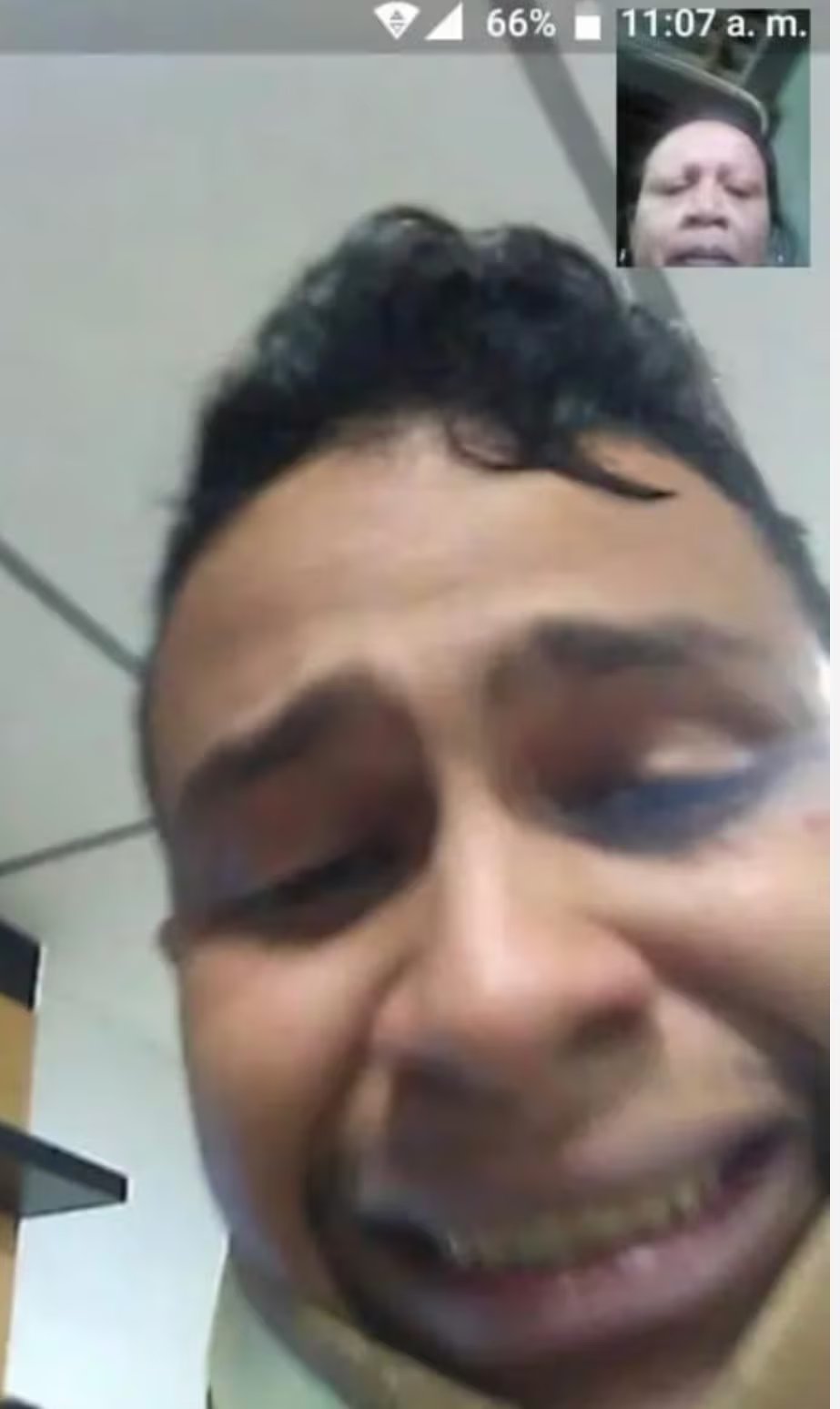     Primo piano del volto di un giovane sofferente.