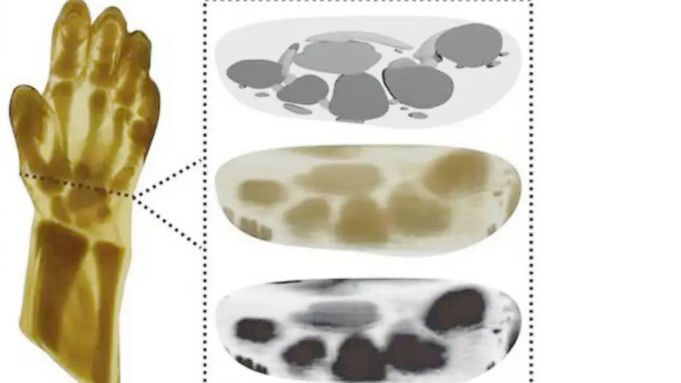 Una mano umana realistica viene stampata in 3D utilizzando un