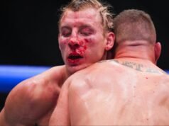 Paddy Pimblett rompe il silenzio sui social media con una dichiarazione di classe dopo la sconfitta a UFC 324