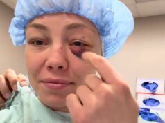 Rose Namajunas viene operata dopo essere stata “pugnalata più volte in un occhio” a UFC 324