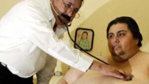 La prevalenza nazionale dell’obesità è aumentata